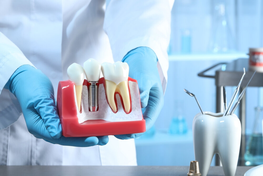 our dental clinic provides dental implants service