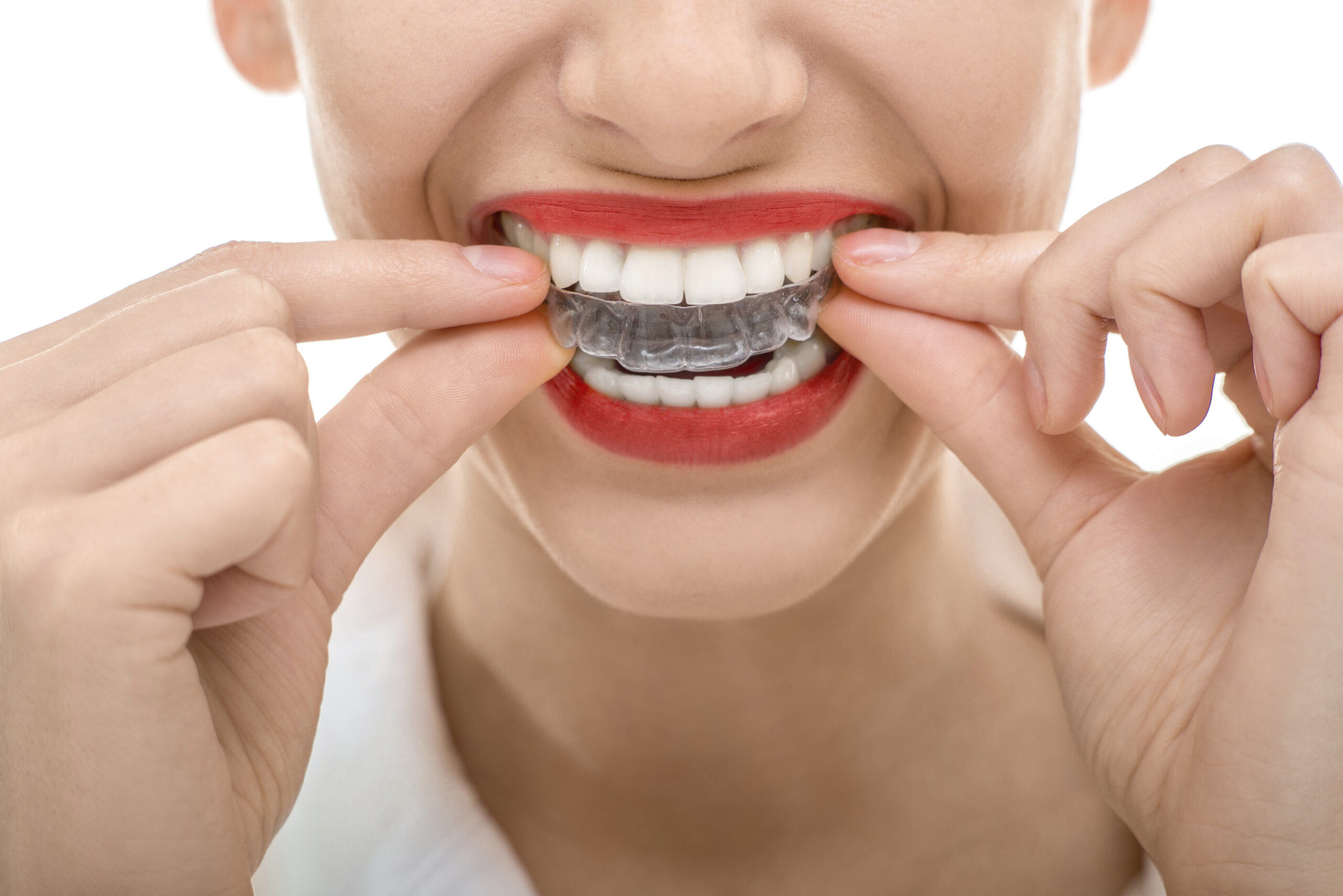 maintaining oral hygiene while using invisalign tips and tricks
