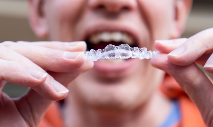 invisalign near you