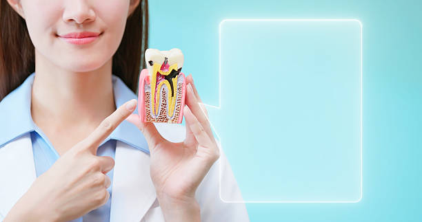 what are the signs you need a root canal