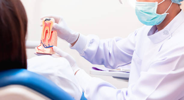 how root canal therapy saves your natural tooth
