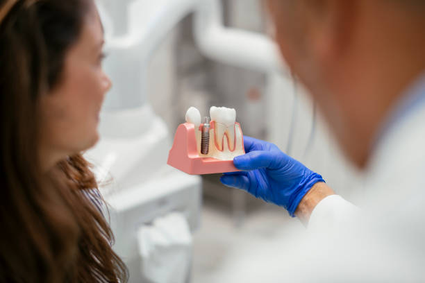 how to care for your dental implants